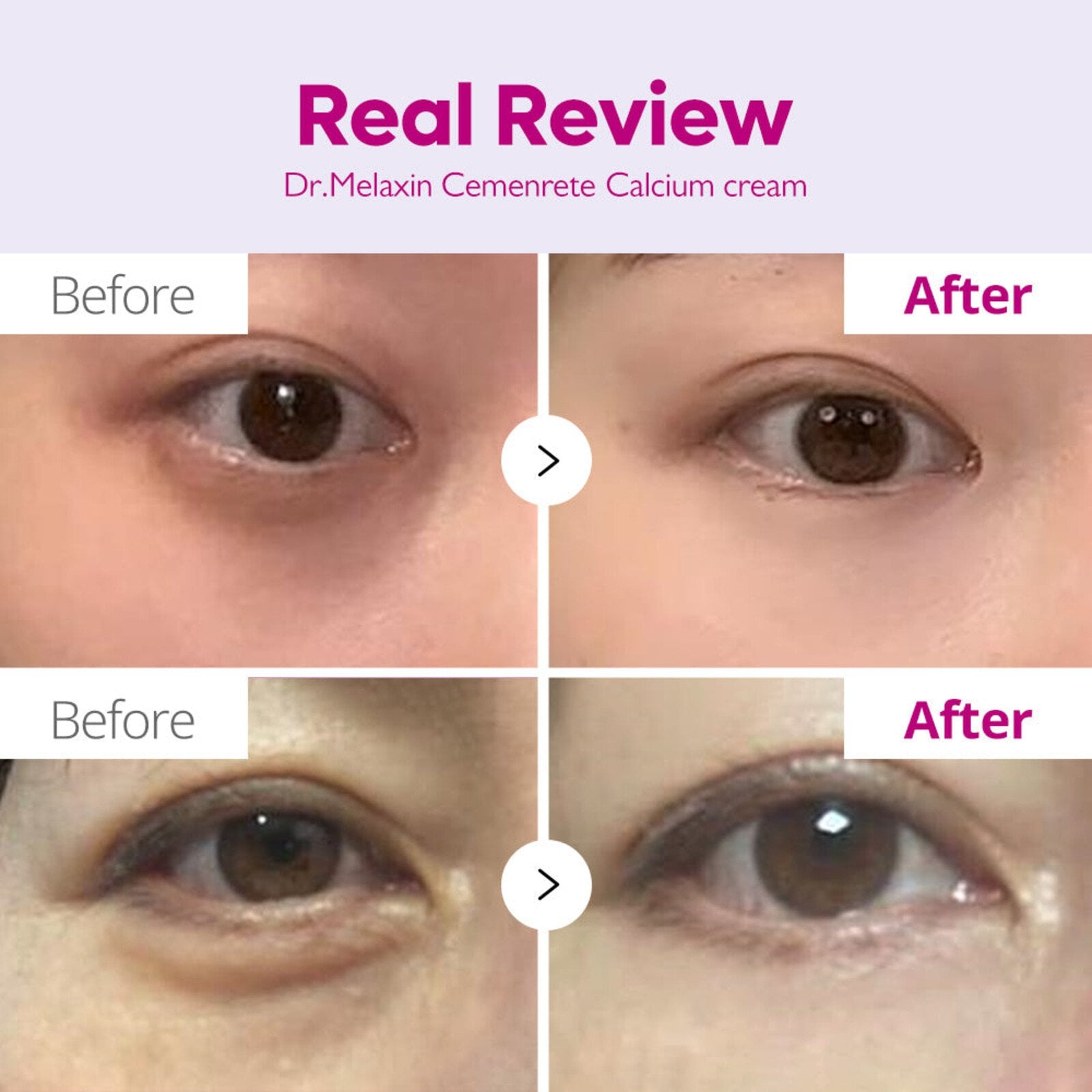 Dr.Melaxin Cemenrete Calcium Intense Cream 50ml (1.69floz)
