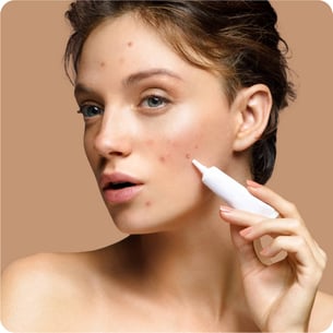 Salicylic Acid