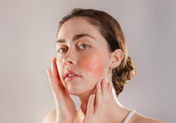 Why Does My Face Burn After Putting on Skincare?