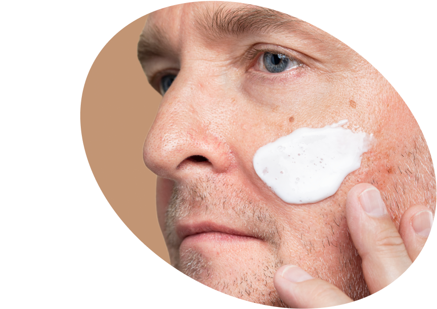 Actinic Keratosis Sunscreens - Shop Very High Protection SPF USA