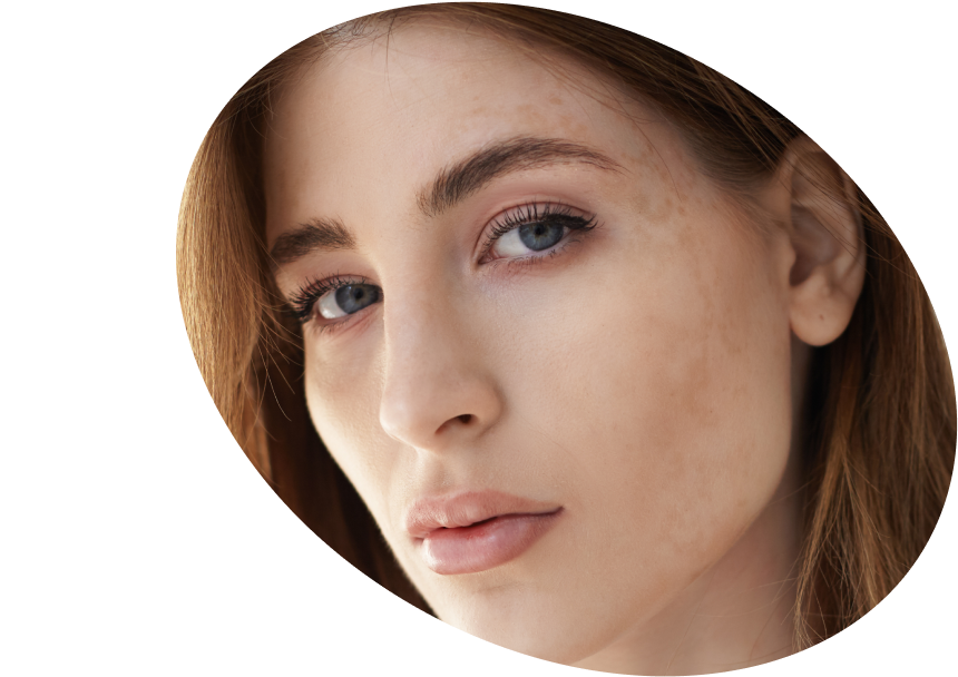 Dark Spots Sunscreen - Shop High Protection SPF for Dark Spots USA