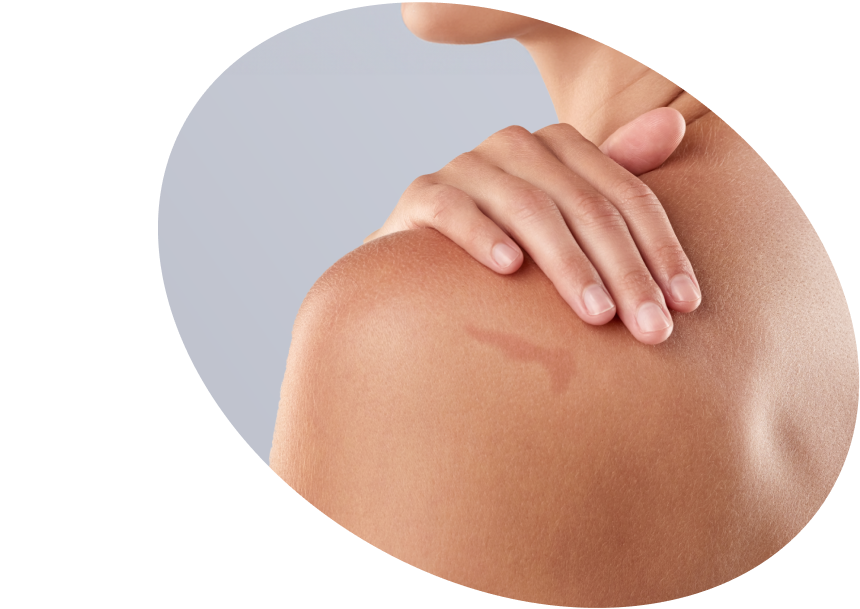 Dark Spots &amp; Body Hyperpigmentation - Shop Brightening Products USA