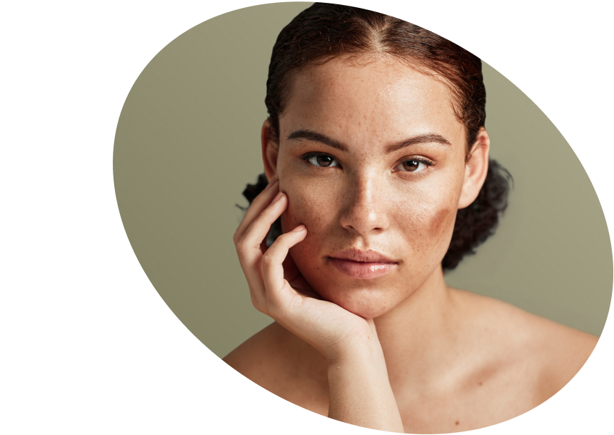 Dark Spots &amp; Face Hyperpigmentation - Shop Brightening Products USA